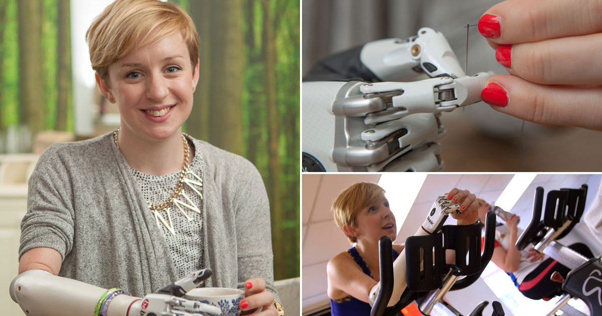 bebionic-small-hand-prosthetic-hand-main
